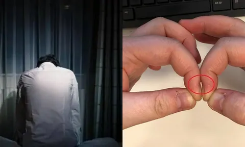 Tại sao ung thư phổi khi phát hiện thường đã ở giai đoạn cuối?