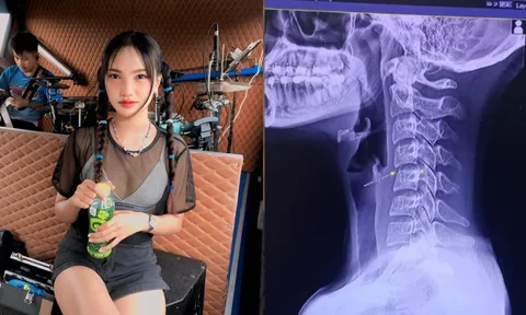 Uẩn khúc vụ nữ ca sĩ qua đời khi đi Massage