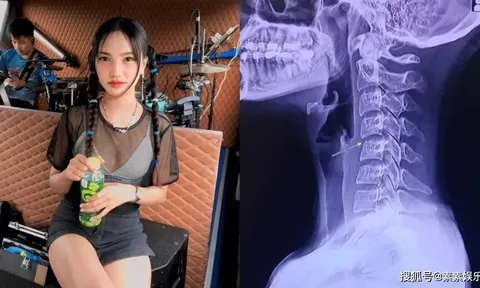 Nguyên nhân bất ngờ vụ nữ ca sĩ qua đời nghi sau khi đi massage