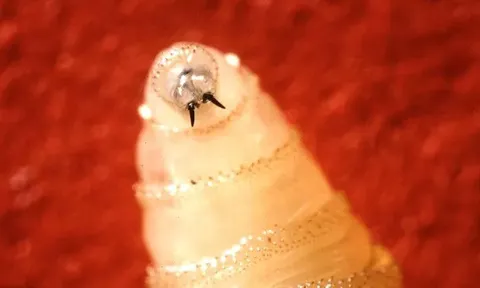 Cảnh báo loại ký sinh trùng 'ăn thịt' cực nguy hiểm có dấu hiệu quay trở lại và lan rộng: Những điều cần biết