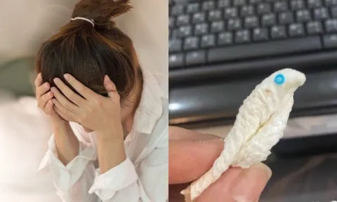 Mũi đau rát, tưởng côn trùng – ai ngờ là… dụng cụ nha khoa