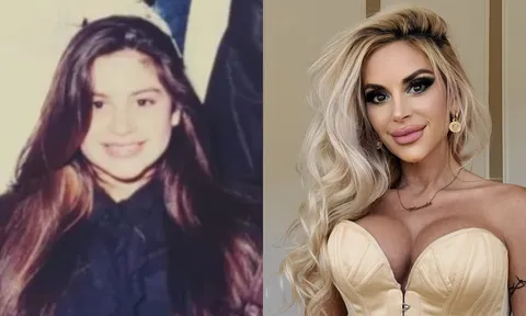 Bà chủ doanh nghiệp vung tiền truyền máu từ con trai để "cải lão hoàn đồng"