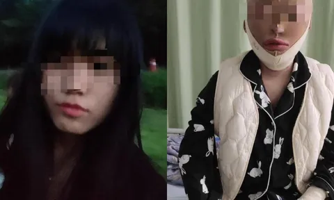 12 năm tù cho thanh niên tạt xăng hủy hoại cuộc đời bạn gái vì đòi chia tay