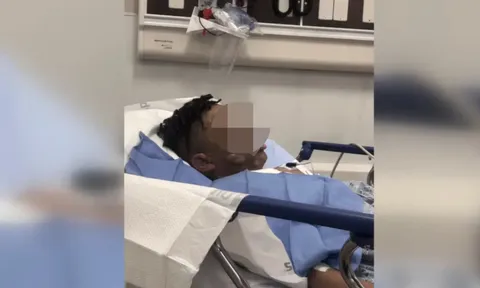 Trò đùa bằng thứ gia đình Việt nào cũng có sẵn mỗi ngày, cậu bé 12 tuổi bị biến dạng khuôn mặt