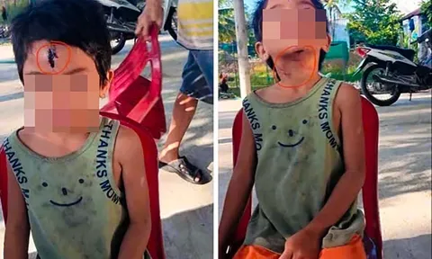 Bé 6 tuổi nghi bị cha dượng bạo hành ở Kiên Giang: Tình tiết gây sốc từ quá khứ tới hiện tại, đều liên quan đến người sống cùng mẹ