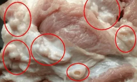 4 bộ phận của lợn nhiều người mê tít nhưng chuyên gia khuyên nên hạn chế kẻo "rước bệnh"
