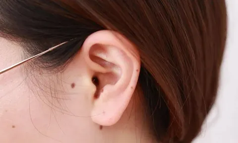 Đừng lướt qua nếu bạn có 5 dấu hiệu này! Xem ngay số 3 để cứu lấy chính mình