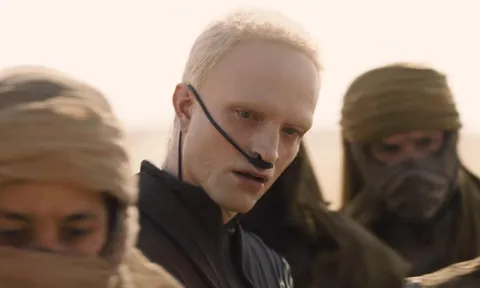 Robert Pattinson gây sốc với tạo hình "hủy dung nhan": Phép thử liều lĩnh lấn át cả dàn sao Dune 3