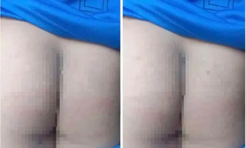 Vụ phụ huynh vào tận trường đánh học sinh 10 roi trước mặt cô giáo: Chính quyền vào cuộc