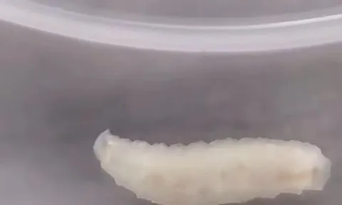 Lỗ hổng an toàn thực phẩm tại "siêu đô thị": Khi giun xuất hiện trong bữa trưa học sinh ở Thượng Hải