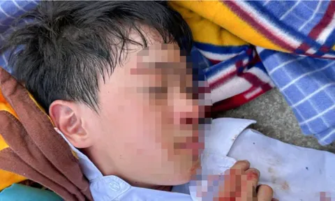 Nam sinh lớp 6 bị đánh chảy máu đầu phải nhập viện ở Nha Trang: Bất ngờ lý do gia đình không yêu cầu xử lý