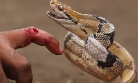 Giây phút sinh tử của người đàn ông bị rắn hổ mang cắn: Độc tính phát tác gây liệt tay, khó thở