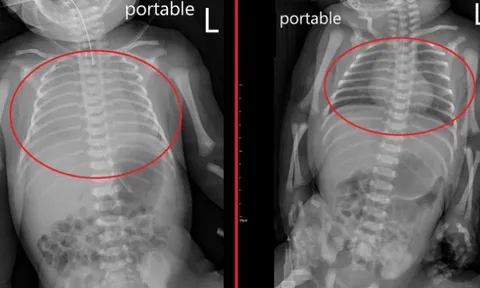 Bé sơ sinh ngừng khóc rồi lịm đi, người cha chết lặng khi bác sĩ vạch mặt "thủ phạm" không ngờ tới