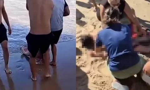 Rùng mình khoảnh khắc cô gái 19 tuổi ở Brazil bị cá mập tấn công, đứt chân phải khi đang tắm biển