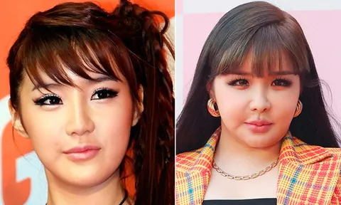 Từ “át chủ bài” của YG đến biểu tượng lụi tàn vì scandal: Hành trình khiến Kpop tiếc nuối nhất gọi tên Park Bom