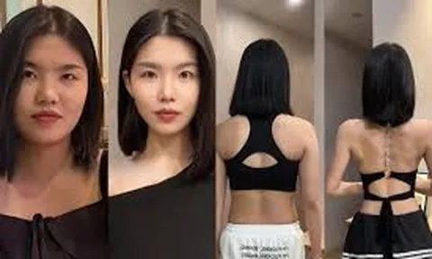 Từ lưng thô, vai gù thành dáng người thanh thoát: Cô gái Trung Quốc tiết lộ 3 bài tập giúp trẻ hóa diện mạo