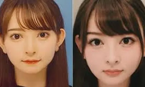 Bỏ gần 1,8 tỷ đồng để làm đẹp nhưng ai cũng tưởng... chưa từng dao kéo, hot girl Nhật gây tranh cãi