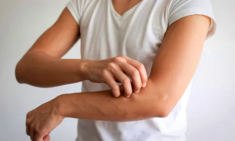 Bác sĩ cảnh báo: Dấu hiệu "lạ" trên da báo hiệu thận suy, nhiều người bỏ qua