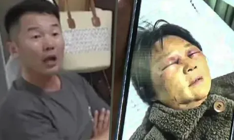 Mẹ ruột bị vợ đánh gãy 4 xương sườn, con trai dửng dưng thốt ra một câu khiến cộng đồng mạng "dậy sóng"