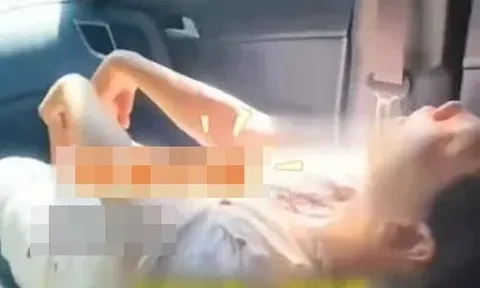 Cãi nhau với chồng, người phụ nữ gặp tình trạng khó tin khiến bác sĩ cũng phải sững sờ