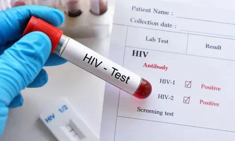 Cô gái 29 tuổi sụp đổ khi cầm kết quả dương tính HIV, chi tiết "đêm định mệnh" khiến người mê app hẹn hò toát mồ hôi hột