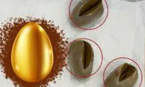 Giấu 3 khối vàng trong trực tràng, hành khách sa lưới hải quan