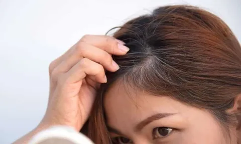 Tóc bạc sớm ở người trẻ ngày càng phổ biến: Chuyên gia cảnh báo nhiều nguyên nhân ít ai ngờ tới