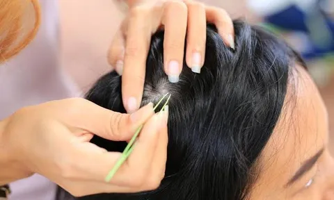 Vì sao người xưa khuyên kiêng nhổ tóc bạc?
