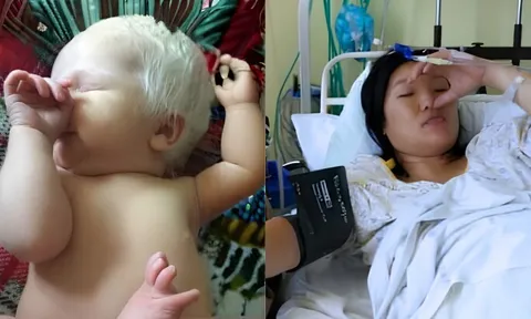 Vợ chồng tóc đen, con sinh ra tóc trắng như tuyết, chồng nghi ngờ mình bị "đổ vỏ"