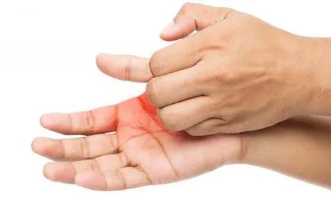 Ngứa lòng bàn tay, bàn chân kéo dài: Cẩn thận dấu hiệu liên quan đến bệnh gan