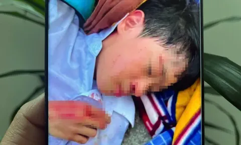 Vụ nam sinh lớp 6 bị bạn học đánh hội đồng: Thông tin chính thức từ công an, hé lộ nguyên nhân đau lòng