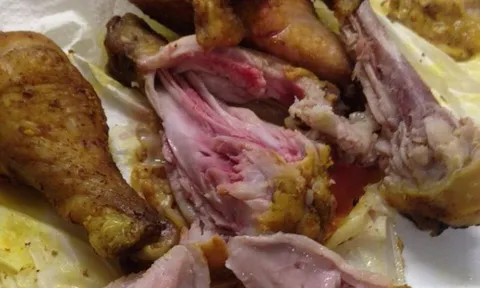 Chỉ từ một bữa ăn tưởng chừng bình thường, người đàn ông 70 tuổi ngộ độc rồi tử vong sau gần 4 tuần điều trị