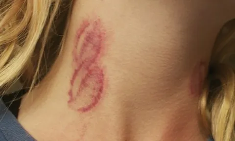 Đang cãi vã ở điểm ngắm hoa anh đào, cụ ông bất ngờ cắn người phụ nữ, diễn biến tiếp theo khiến nhiều người không khỏi hoang mang