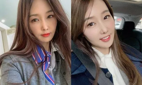 Từng sống trong giàu có, “nữ thần thanh xuân” nay phải đối mặt với khó khăn tài chính, tính toán từng khoản chi tiêu