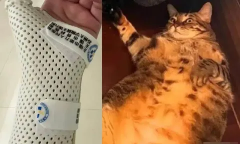 Để mèo cưng gối đầu cả đêm vì không nỡ đánh thức, cô gái nhập viện vì gãy xương cổ tay