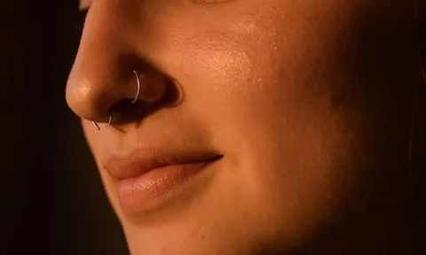 Tưởng mất khuyên mũi, cô gái đi khám mới bàng hoàng "tìm thấy" ở vị trí không ngờ