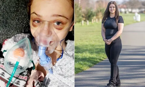 Nổi máu ghen tuông, gã trai ném bạn gái từ tầng 4 khiến cô suýt mất mạng