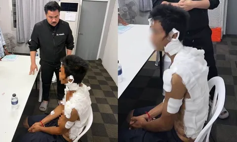 Được đưa đi "nhận lương", nam công nhân bị hành hung, tra tấn trong suốt nhiều giờ
