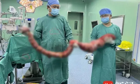 Người đàn ông có chiếc bụng phình to như mang thai nhiều tháng, bác sĩ lấy ra thứ "đáng sợ" bên trong khiến nhiều người rùng mình