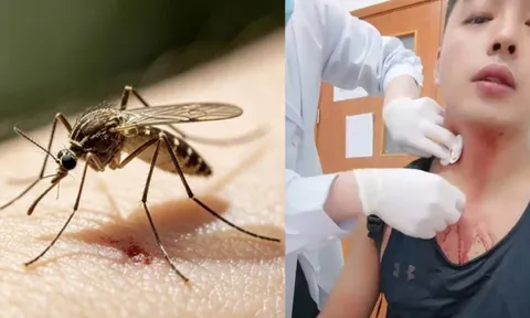 Bị muỗi đốt suýt chết sau khi tập thể dục