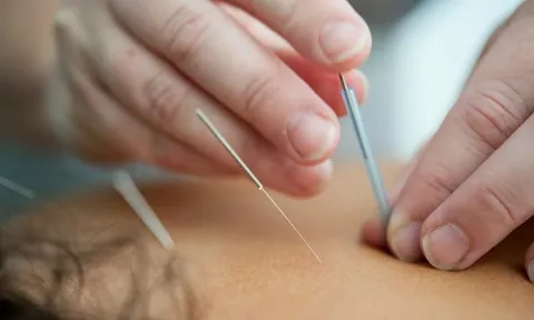 Đau chân dữ dội chỉ sau buổi châm cứu đầu tiên, người phụ nữ đi chụp X-quang rồi phát hiện sự thật khó tin