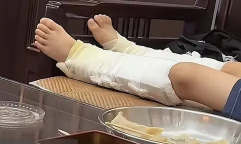 Lén bắt chước siêu nhân nhảy từ trên cao xuống, bé trai gãy cả hai xương gót chân