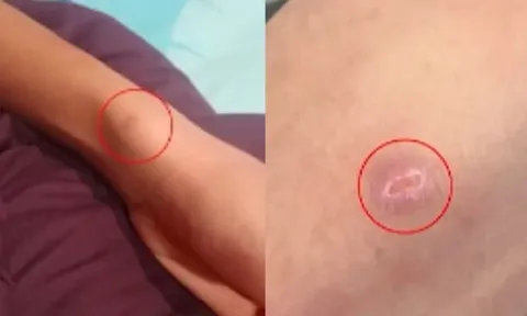 Thấy con trai người đầy vết thương, bố mẹ chết lặng khi nghe em kể chuyện đau lòng xảy ra suốt 2 năm ở trường
