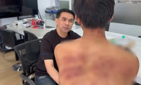 Đi làm với nhiều vết thâm tím trên người, sếp hỏi chuyện mới phát hiện câu chuyện bạo hành kéo dài gần 10 năm của nam thanh niên 18 tuổi