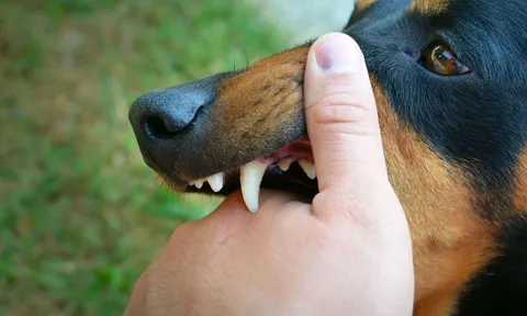 Hai trẻ nhỏ bị chó dữ lao vào tấn công, kết quả xét nghiệm khiến người dân lo lắng