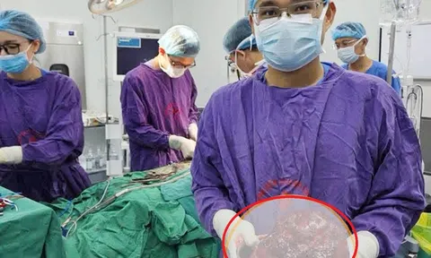 Người đàn ông sụt cân nhưng bụng ngày càng phình to, người đàn ông sốc khi bác sĩ gắp ra thứ "đáng sợ" nặng 2kg bên trong