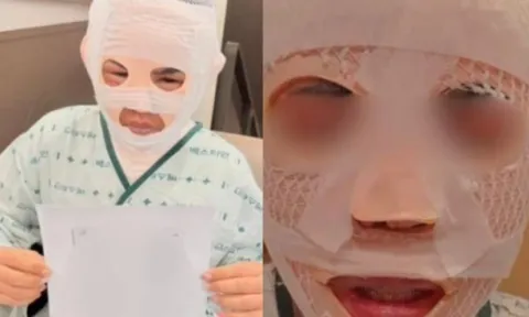 Vợ bất ngờ bị chồng đổ nước sôi lên mặt khi đang ngủ, lời khai ban đầu khiến nhiều người phẫn nộ