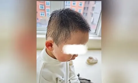 Đang nấu bữa sáng, người mẹ hốt hoảng khi thấy con trai 2 tuổi chạy đến với biểu hiện bất thường