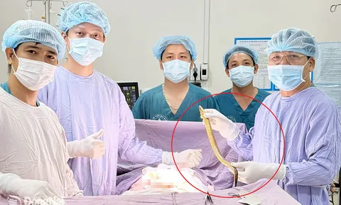 Phát hiện con lươn dài hơn 50cm trong bụng người đàn ông ở Đồng Nai