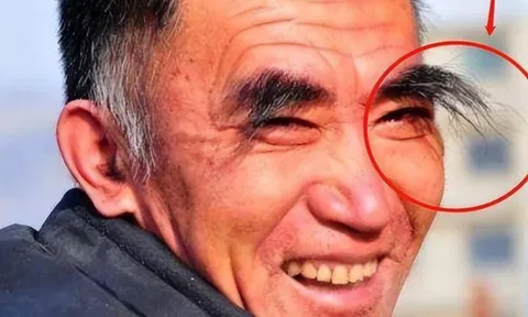 Cổ nhân nói: "30 lông dài thì 40 đột tử, 50 lông mọc là mệnh trường thọ", vì sao thế?